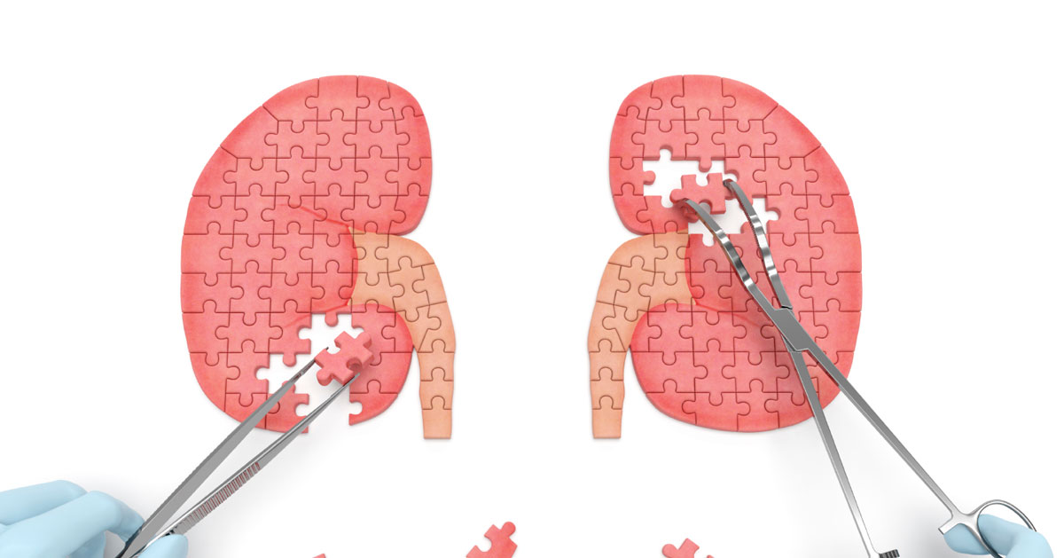 Gout and Kidney Understanding the Link Between Gout and Kidney Problems